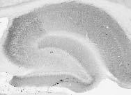Chapsyn-110/PSD-93 Antibody in Immunohistochemistry (Frozen) (IHC (F))
