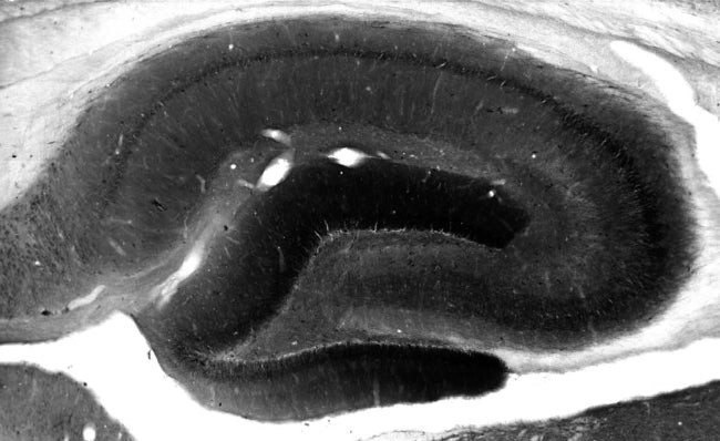 SAP102 Antibody in Immunohistochemistry (Frozen) (IHC (F))