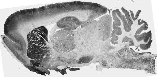 Pink1 PTEN Induced Putative Kinase 1 Antibody in Immunohistochemistry (Frozen) (IHC (F))