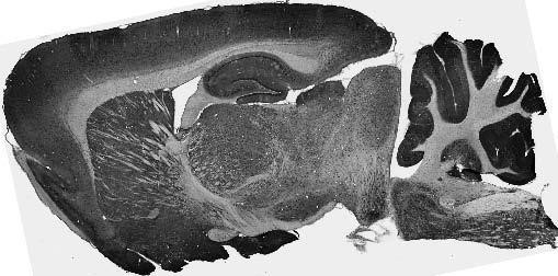 Pink1 PTEN Induced Putative Kinase 1 Antibody in Immunohistochemistry (Frozen) (IHC (F))