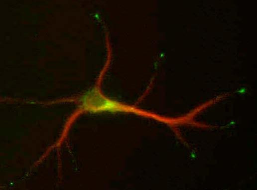 SCG10/Stathmin-2 Antibody in Immunocytochemistry (ICC/IF)