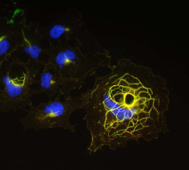 Shank1 Antibody in Immunocytochemistry (ICC/IF)