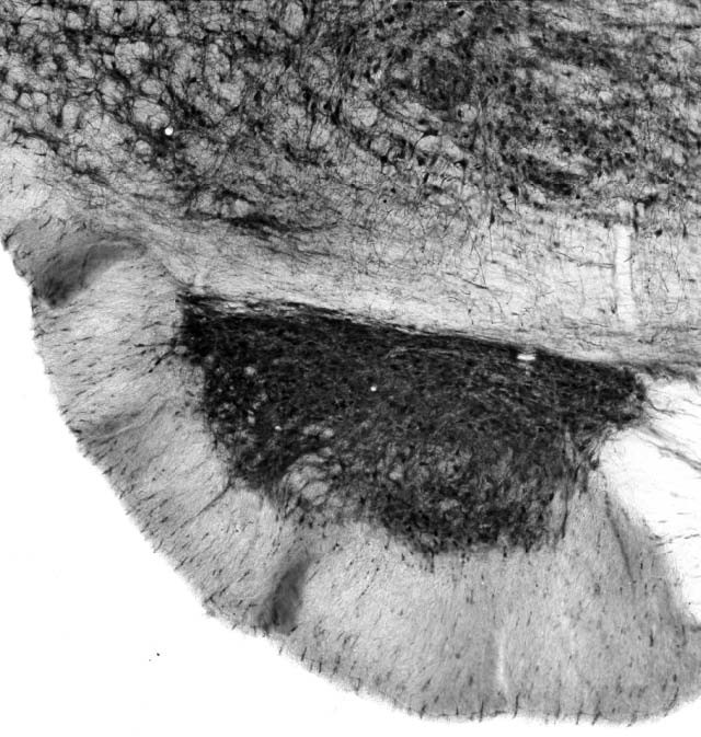 Cavbeta2 Ca2+ Channel Antibody in Immunohistochemistry (Frozen) (IHC (F))