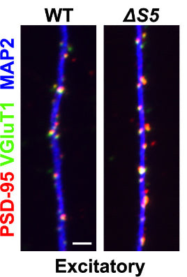 VGlut1 Antibody in Immunocytochemistry (ICC/IF)