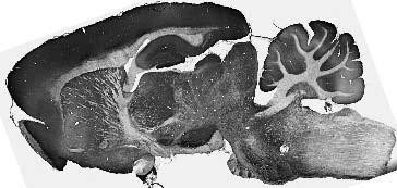Kir2.3 K+ Channel Antibody in Immunohistochemistry (Frozen) (IHC (F))