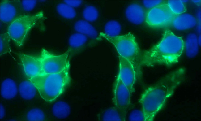 TrpV3 Antibody in Immunocytochemistry (ICC/IF)