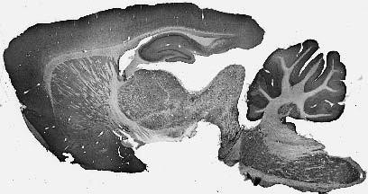 VGlut3 Antibody in Immunohistochemistry (Frozen) (IHC (F))