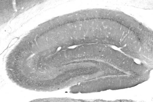 DLX1 Antibody in Immunohistochemistry (Frozen) (IHC (F))
