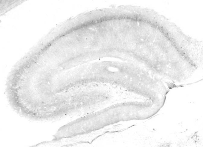 Cav1.3 Ca2+ Channel Antibody in Immunohistochemistry (Frozen) (IHC (F))
