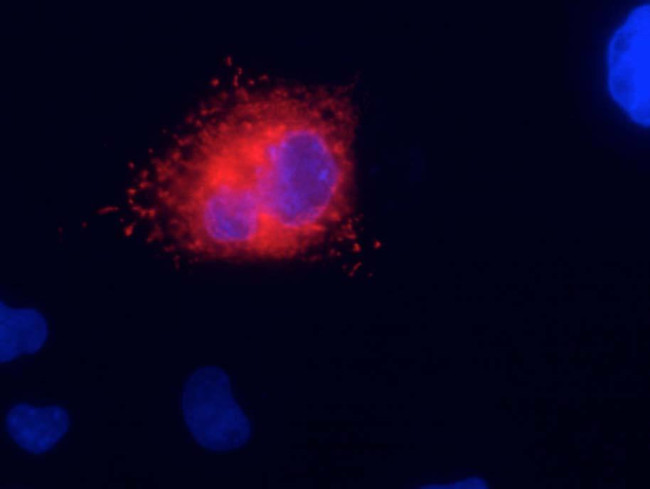 Kv7.1/KCNQ1 K+ Channel Antibody in Immunocytochemistry (ICC/IF)