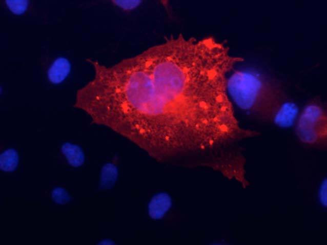 Kv7.4/KCNQ4 K+ Channel Antibody in Immunocytochemistry (ICC/IF)