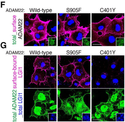 ADAM22 (Cytoplasmic) Antibody in Immunocytochemistry (ICC/IF)