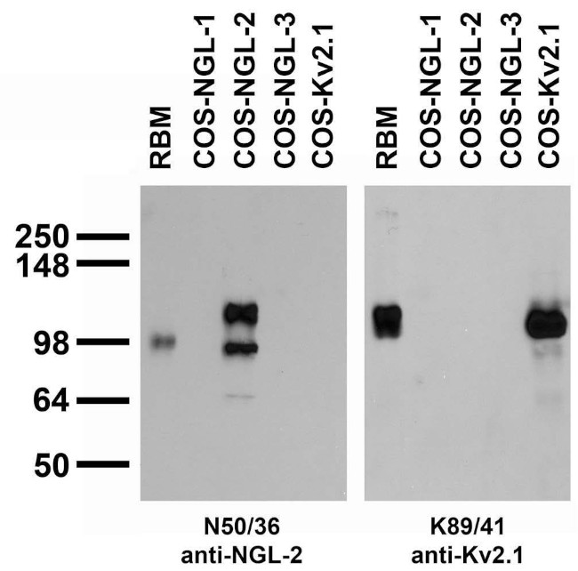 NGL-2/LRRC4 Antibody in Western Blot (WB)