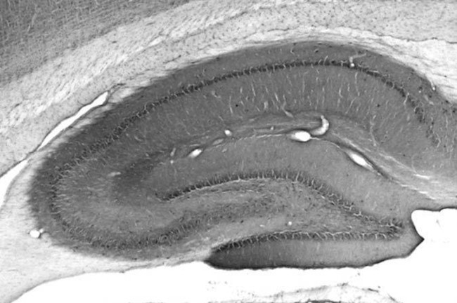BKbeta4 K+ Channel Antibody in Immunohistochemistry (Frozen) (IHC (F))