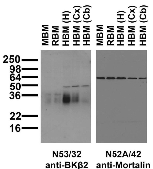BKbeta2 K+ Channel Antibody in Western Blot (WB)