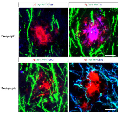 Shank2 Antibody in Immunocytochemistry (ICC/IF)