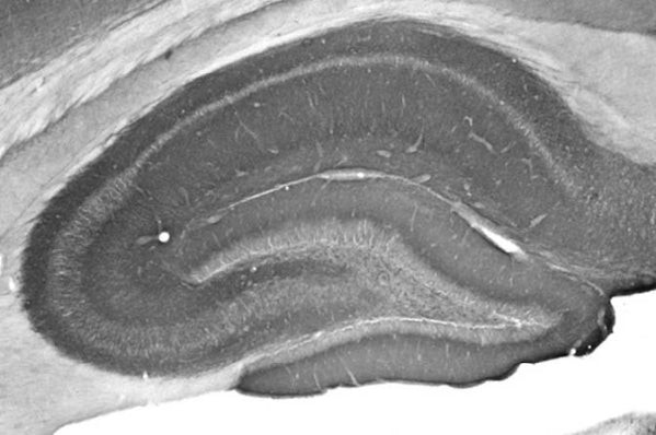 Pan-Shank Antibody in Immunohistochemistry (Frozen) (IHC (F))