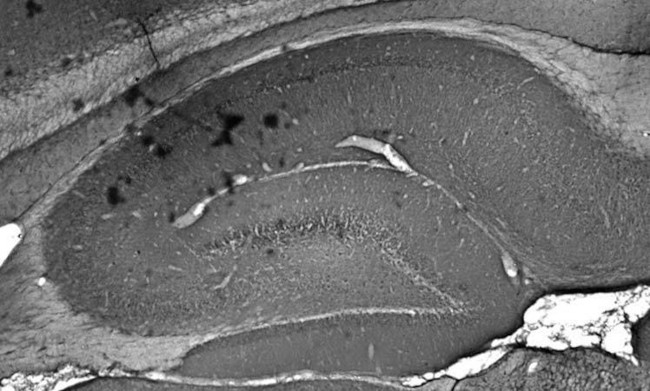 GIT1 Antibody in Immunohistochemistry (Frozen) (IHC (F))