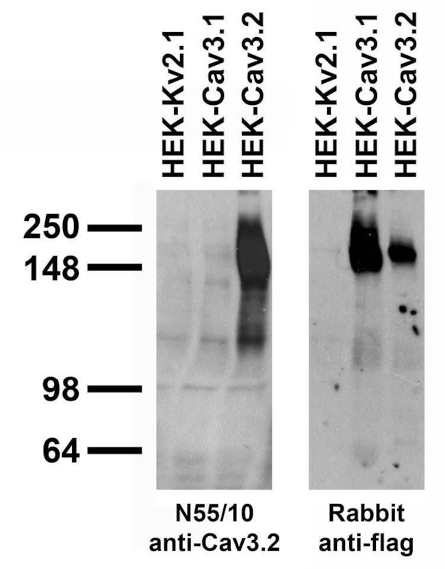 Cav3.2 Ca2+ Channel Antibody in Western Blot (WB)