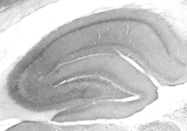 BKbeta3a K+ Channel Antibody in Immunohistochemistry (Frozen) (IHC (F))
