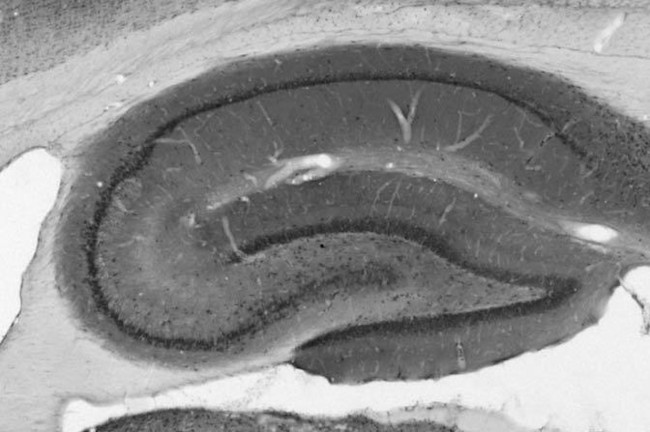 Zinedin Antibody in Immunohistochemistry (Frozen) (IHC (F))