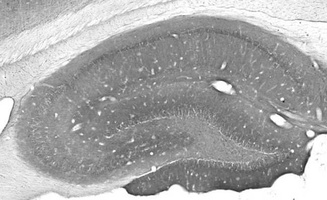 MMP9 Antibody in Immunohistochemistry (Frozen) (IHC (F))