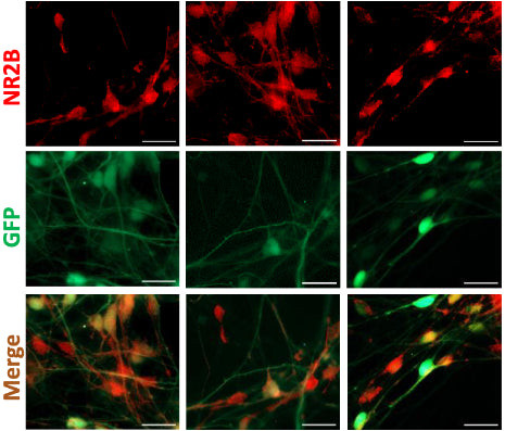 GluN2B/NR2B Glutamate Receptor Antibody in Immunocytochemistry (ICC/IF)