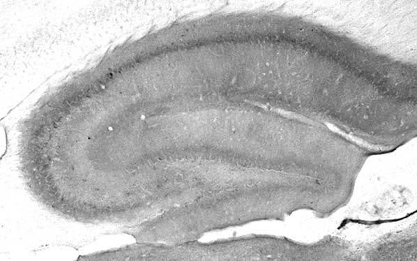 Ataxin-1/WT Antibody in Immunohistochemistry (Frozen) (IHC (F))