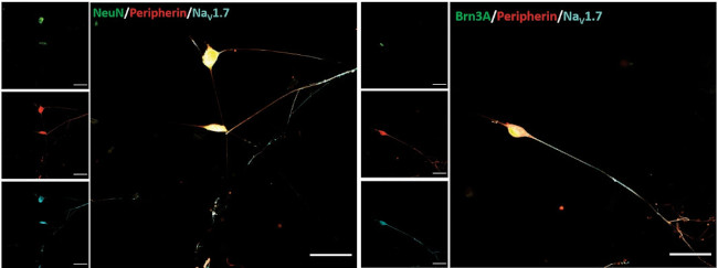 Nav1.7 Na+ Channel Antibody in Immunocytochemistry (ICC/IF)