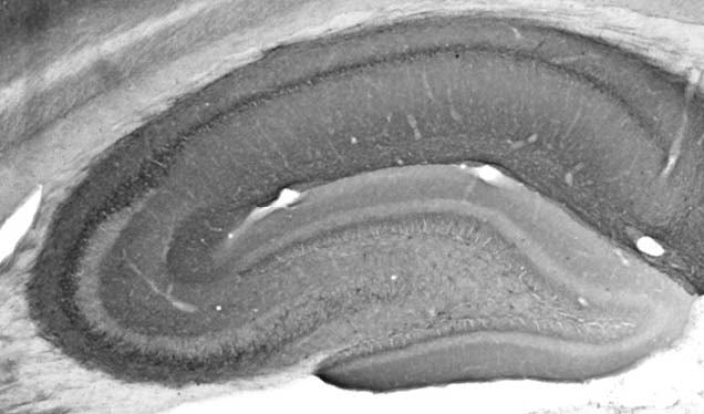 HCN1 Antibody in Immunohistochemistry (Frozen) (IHC (F))