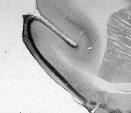 HCN2 Antibody in Immunohistochemistry (Frozen) (IHC (F))