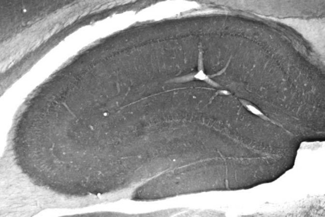 Cav1.3 Ca2+ Channel Antibody in Immunohistochemistry (Frozen) (IHC (F))