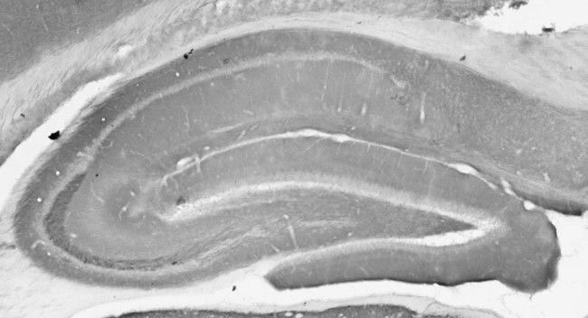 mGluR1/5 (Group I) Glutamate Receptor Antibody in Immunohistochemistry (Frozen) (IHC (F))