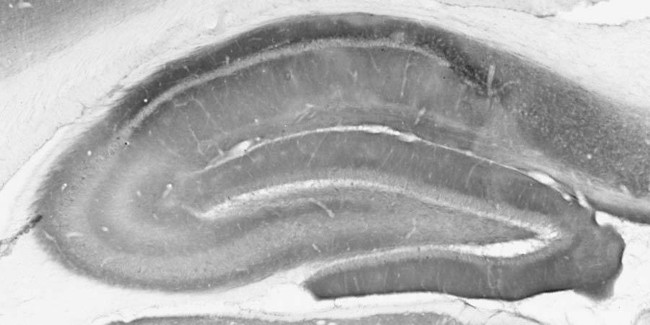 mGluR1/5 (Group I) Glutamate Receptor Antibody in Immunohistochemistry (Frozen) (IHC (F))
