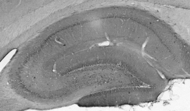 SALM2/LRFN1 Antibody in Immunohistochemistry (Frozen) (IHC (F))