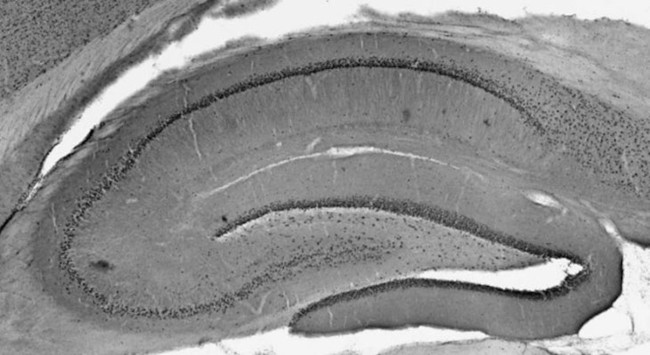 Ataxin-1/11NQ Antibody in Immunohistochemistry (Frozen) (IHC (F))