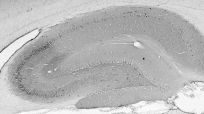 TrpC7 Antibody in Immunohistochemistry (Frozen) (IHC (F))