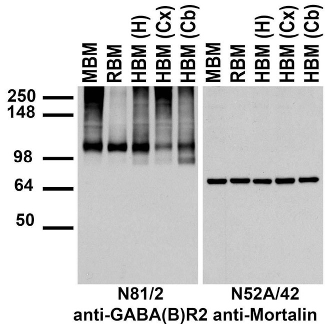 GABA-B-R2 Antibody in Western Blot (WB)