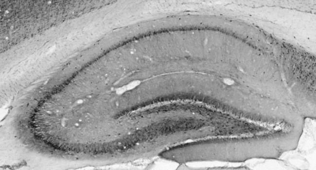 GIT2 Antibody in Immunohistochemistry (Frozen) (IHC (F))