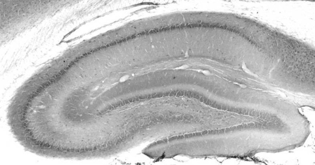 MESD Antibody in Immunohistochemistry (Frozen) (IHC (F))