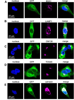 GFP Antibody in Immunocytochemistry (ICC/IF)