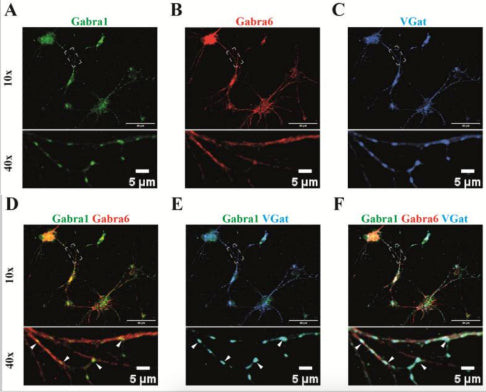 GABA-A-R/Alpha1 Antibody in Immunocytochemistry (ICC/IF)
