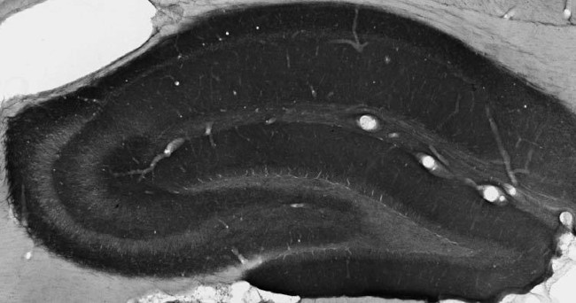 GABA-A-R/Beta1 Antibody in Immunohistochemistry (Frozen) (IHC (F))