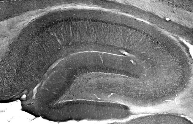 Copper ATPase 1 (Menke's Disease Protein) Antibody in Immunohistochemistry (Frozen) (IHC (F))
