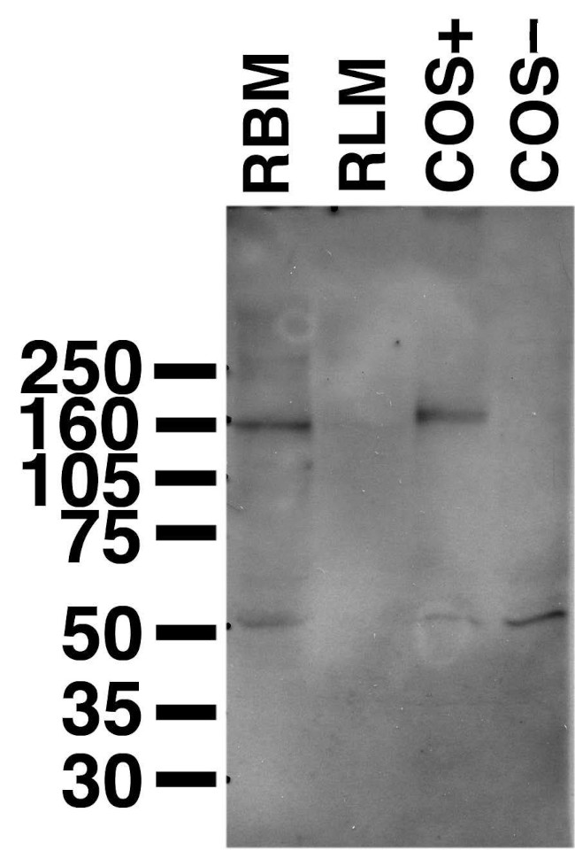 Copper ATPase 2 (Wilson's Disease Protein) Antibody in Western Blot (WB)