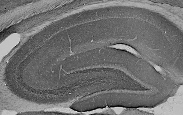 Ankyrin-B Antibody in Immunohistochemistry (Frozen) (IHC (F))