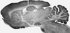 GABA-A-R/Beta3 Antibody in Immunohistochemistry (Frozen) (IHC (F))