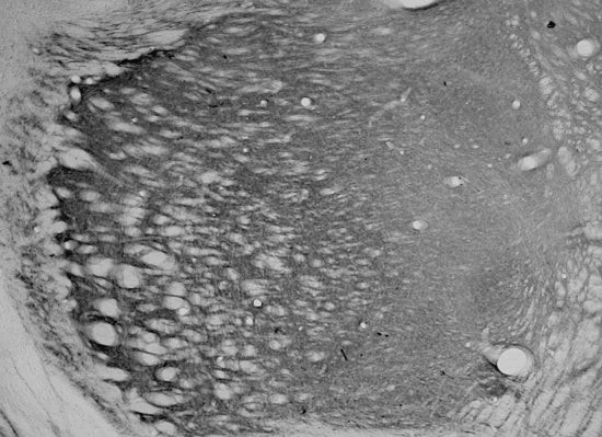 HCN4 Antibody in Immunohistochemistry (Frozen) (IHC (F))