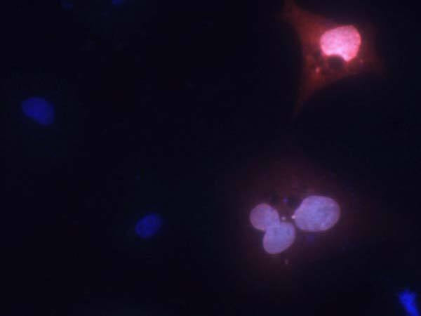 MPP8 Antibody in Immunocytochemistry (ICC/IF)