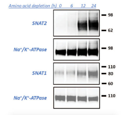 SNAT1 Antibody in Western Blot (WB)